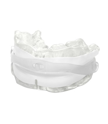 SomnoFit Unterkieferprotrusionsschiene gegen Schnarchen – Oscimed