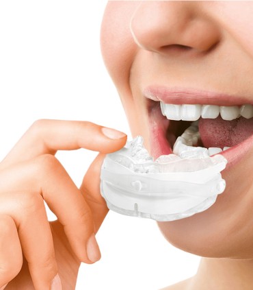 SomnoFit Unterkieferprotrusionsschiene gegen Schnarchen – Oscimed